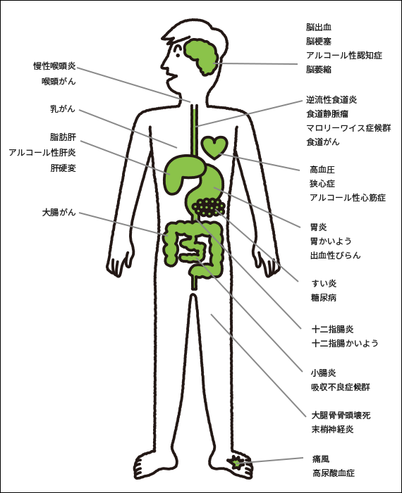 お酒が引き起こす生活習慣病